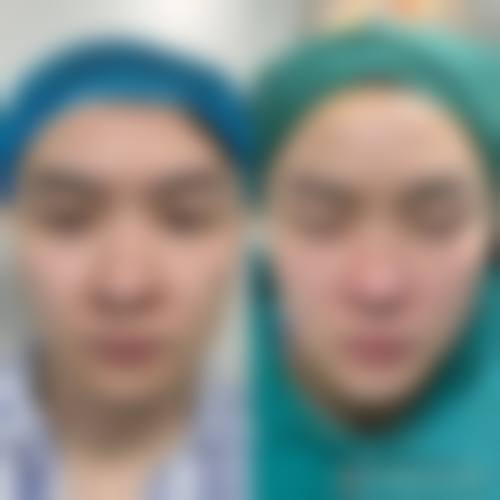 九、淮北天煌整形医院真实的患者评价