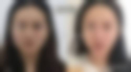 八、深圳医嘉整形医院真实的患者评价