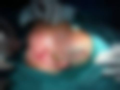 二、深圳医嘉整形医院怎么样？