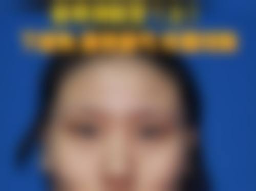 七、深圳医嘉整形医院预约方式