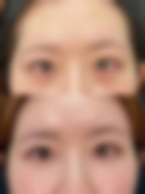 五、吉林赵艳君整形医院价格表