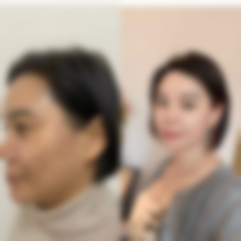 二、全身抽脂常见部位及成效