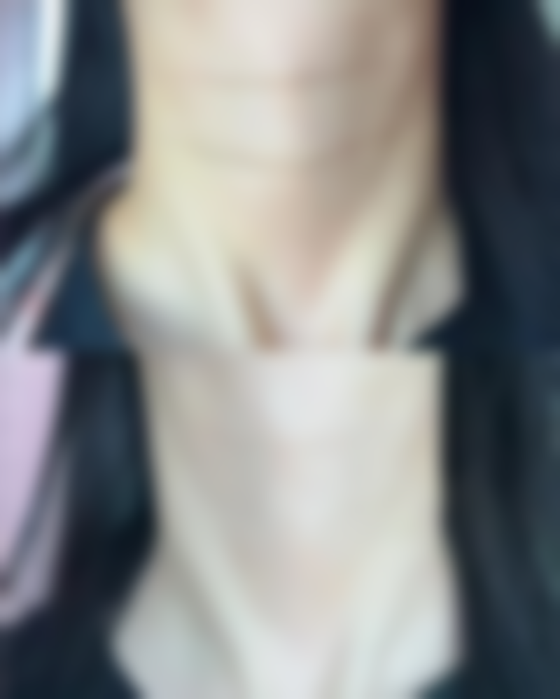 三、女人减肥抽脂的重度并发症