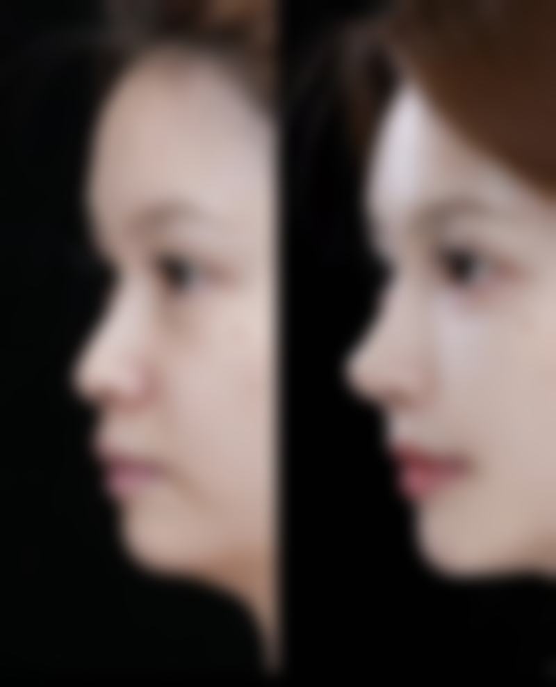 南阳爱贝尔医院整形美容科特色项目