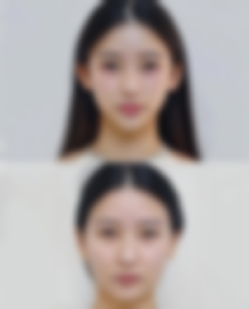 五、全身抽脂的正确认知