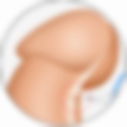 一、微针去眼袋保持多久