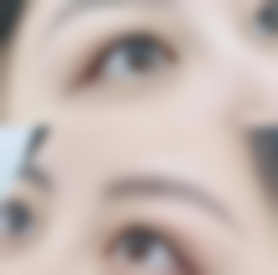 微针去眼袋保持多久有效果？影响因素及延长效果技巧大揭秘！ 