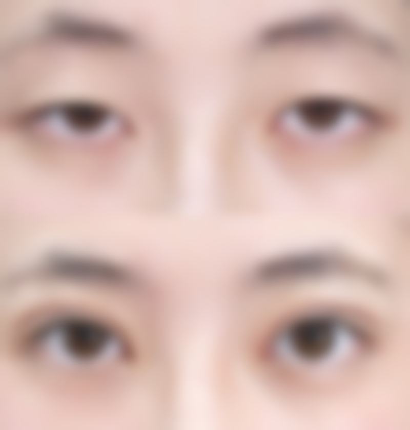 七、总结：轻松应对，找回明亮眼神