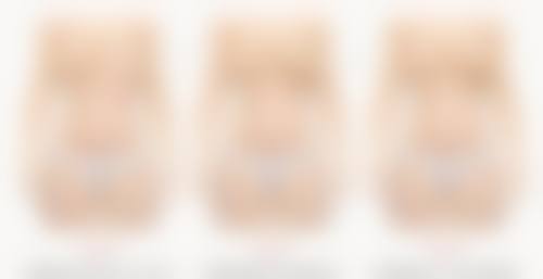 手术去眼袋修复期要多久才能修复？总结