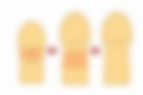 眼袋内切伤口多久愈合好？了解恢复阶段与影响因素，轻松迎接美丽蜕变 