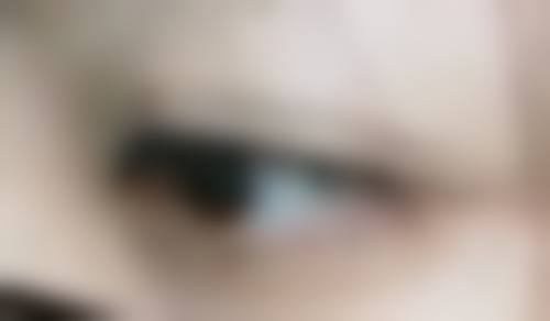 五、吸脂减肥后如何维护成效？