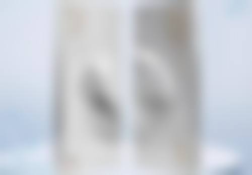 二、眼袋内切伤口多久愈合