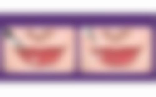 七、南昌圣美医疗美容诊所预约方式