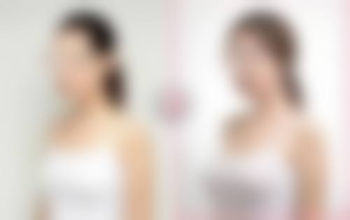 呼和浩特伊思医疗美容诊疗项目有哪些？