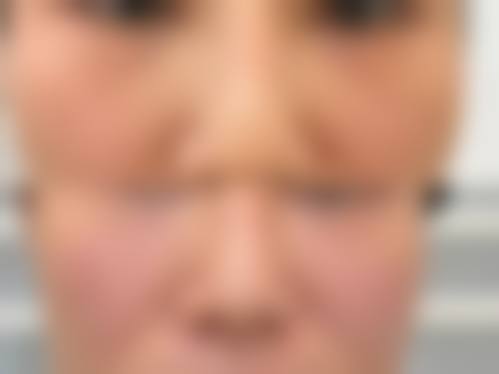 七、徐州伊博士整形医院预约方式