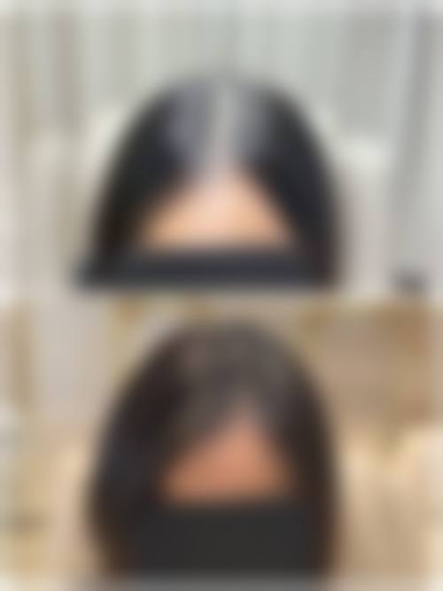 二、徐州伊博士整形医院怎么样？