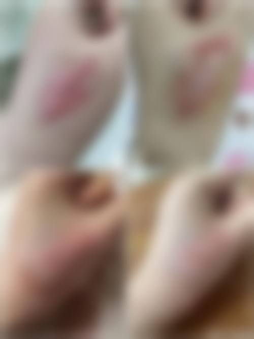 八、南昌圣美医疗美容诊所真实的患者评价