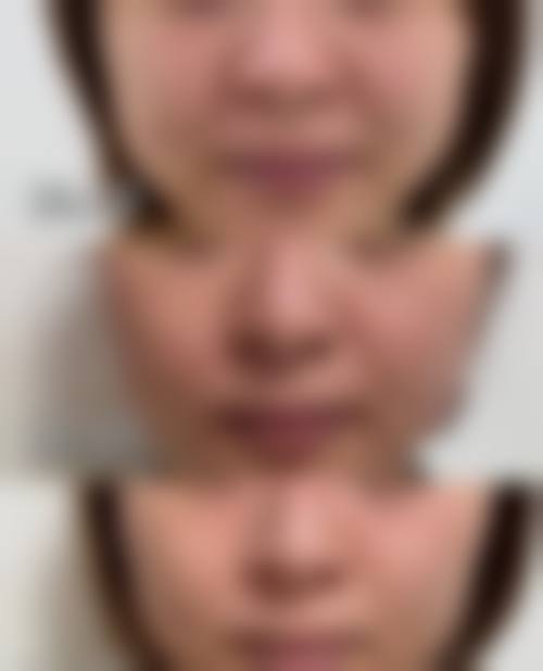 四、鄂尔多斯天安医疗美容诊所特色项目