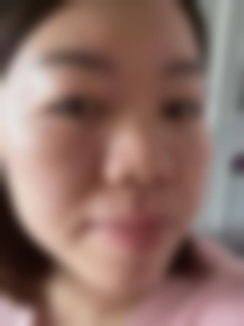 八、广安美媛芳龄整形医院真实的患者评价