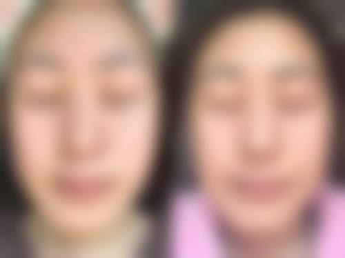 三、广安美媛芳龄整形医院诊疗项目有哪些？