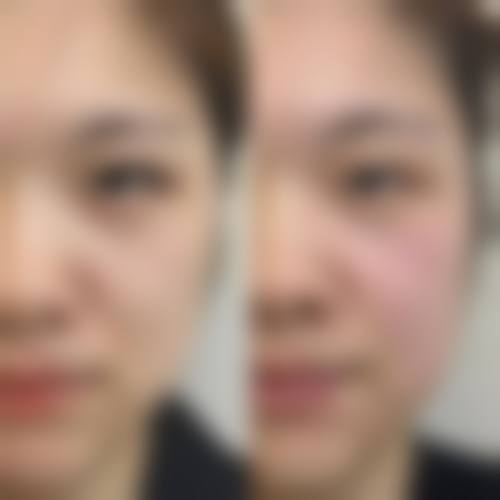 八、长沙思瑞医疗美容门诊部真实的患者评价