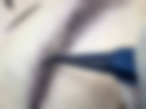 四、重庆爱丽美整形美容门诊部特色项目