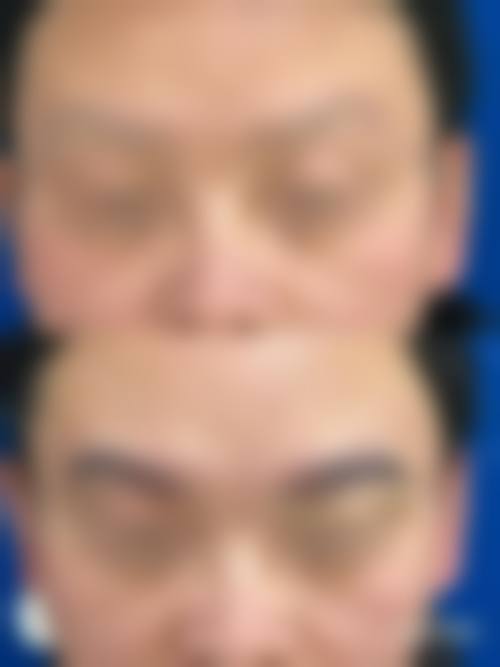 六、韩国爱佩思APEX整形外科价格表