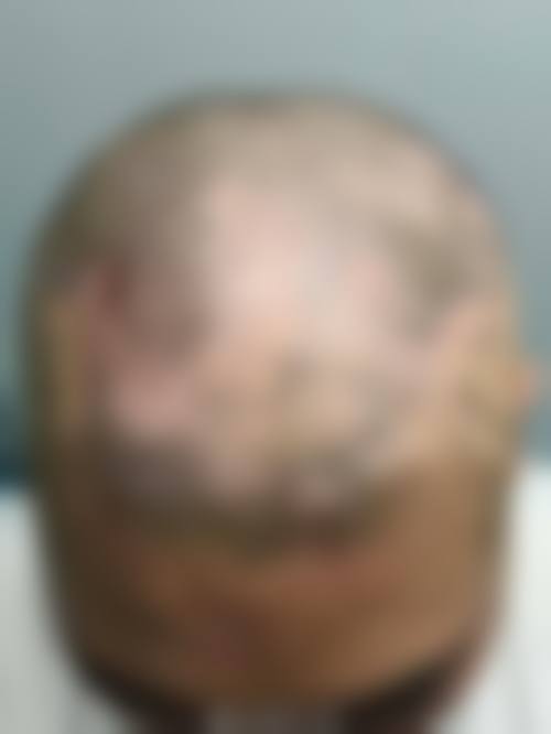 二、韩国爱佩思APEX整形外科怎么样？