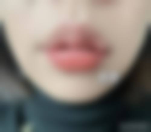 八、青海康华整形医院真实的患者评价