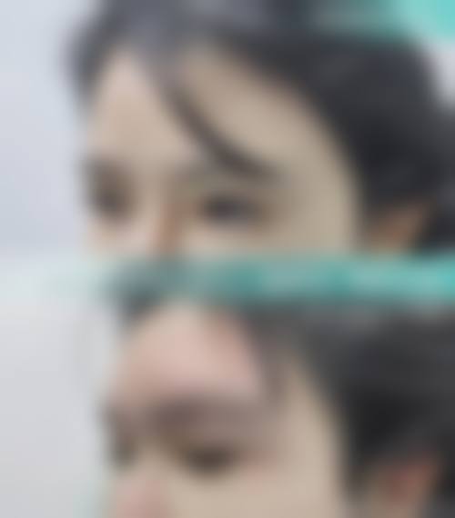 三、台州倍芙谜整形医院诊疗项目有哪些？