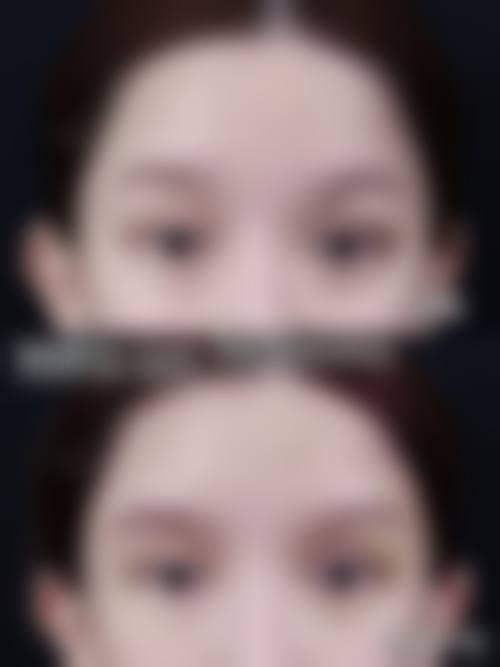 三、昭通爱丽诺美容整形诊疗项目有哪些？