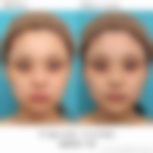 九、昭通爱丽诺美容整形真实的患者评价