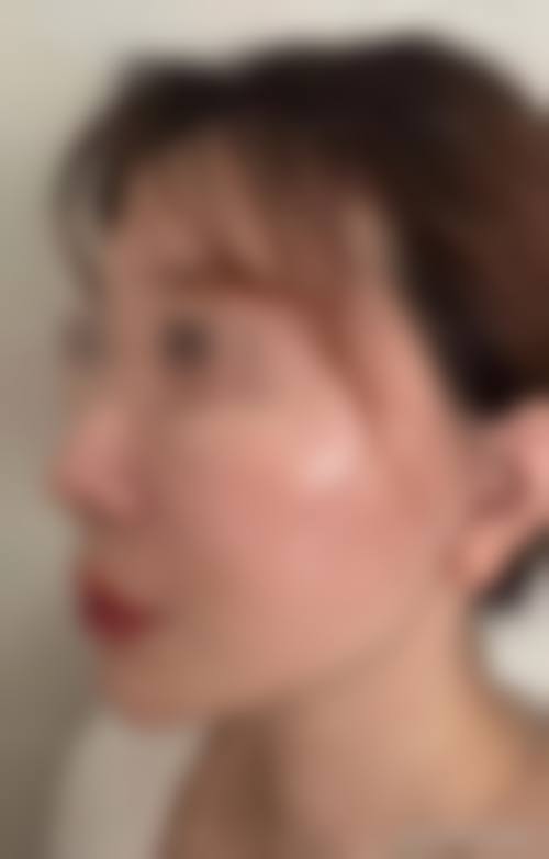 六、齐齐哈尔美莱尔整形医院价格表