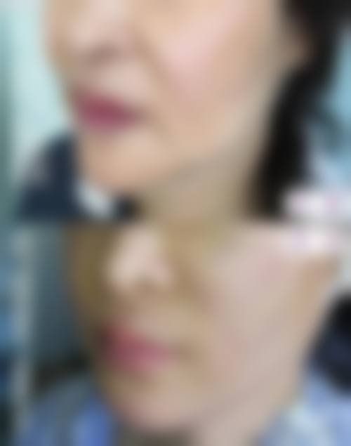 二、重庆爱丽美整形美容门诊部怎么样？