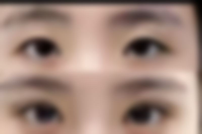 呼和浩特伊思医疗美容特色项目