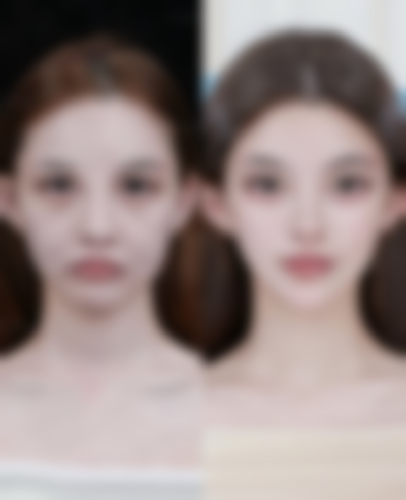 脸部抽脂后多久看到效果显著？了解恢复阶段与影响因素，助你科学变美 