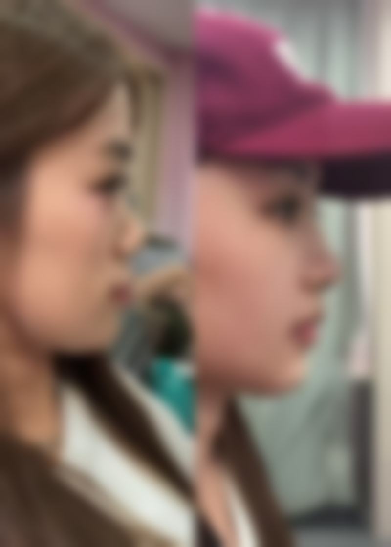 九、北京凝萱整形医疗美容诊所真实的患者评价