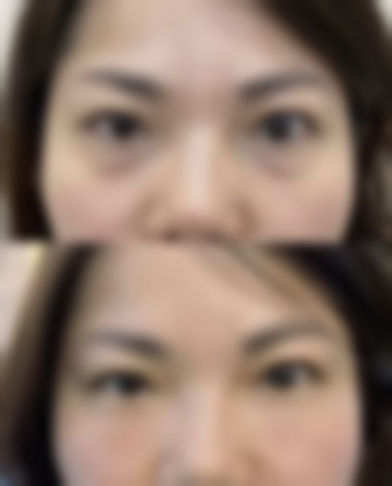 五、烟台奥拉克医疗美容价格表