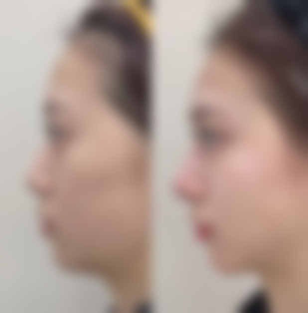 六、烟台奥拉克医疗美容地址及交通