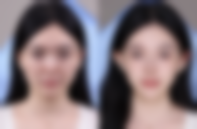 二、烟台奥拉克医疗美容怎么样？