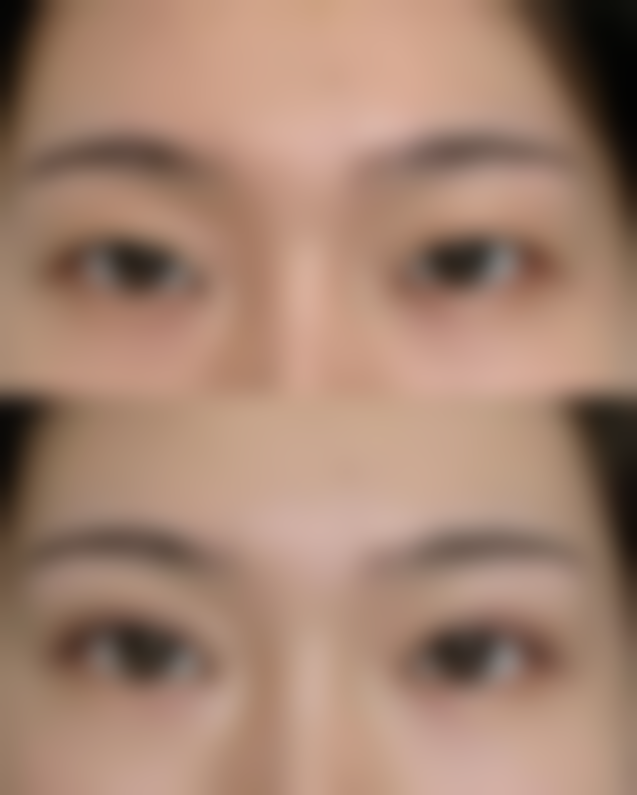 二、台州倍芙谜整形医院怎么样？