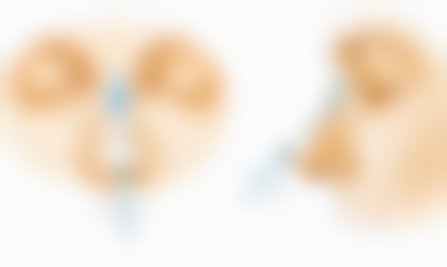 二、影响油烫伤红色疤痕消退的因素