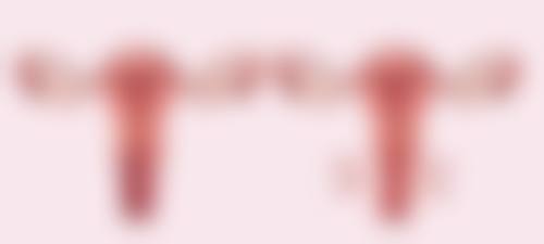 一、双眼皮手术拆线时间的常规规定