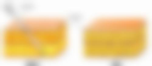 三、不同部位隆鼻手术的拆线时间及注意事项