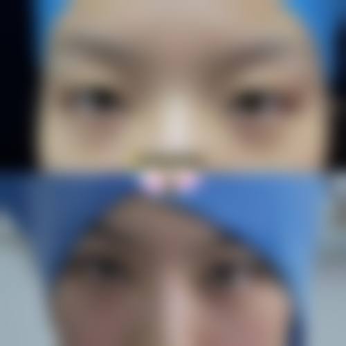 四、日本日比谷美容外科医院特色项目