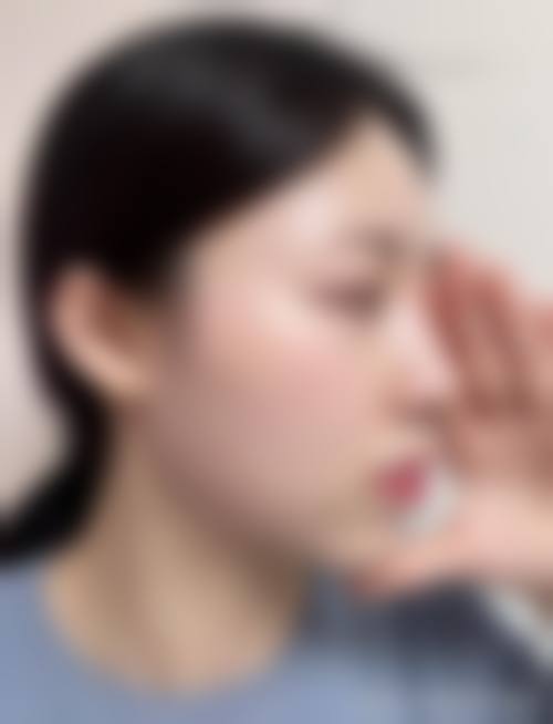 五、杭州革革臻美医疗美容诊所价格表