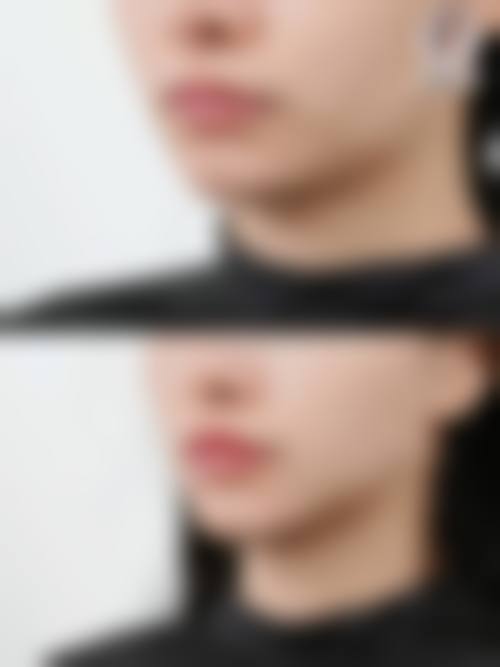 三、杭州革革臻美医疗美容诊所诊疗项目有哪些？