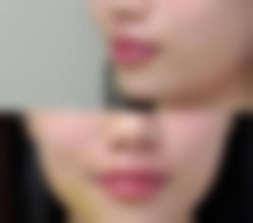 二、上虞亚韩医疗美容美容诊所怎么样?