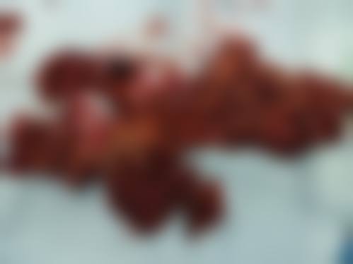 四、金华丽都整形美容医院特色项目