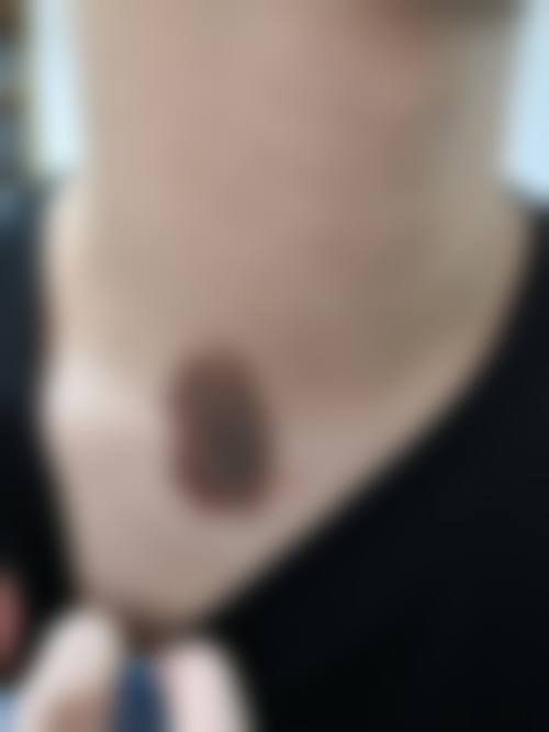 八、杭州革革臻美医疗美容诊所真实的患者评价